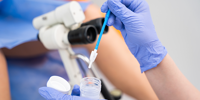  El diagnóstico de VPH requiere pruebas de seguimiento