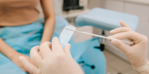 Papanicolaou por edades a partir de los 21 años.